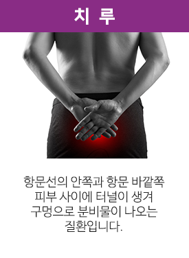 치루. 항문선의 안쪽과 항문 바깥쪽 피부 사이에 터널이 생겨 구멍으로 분비물이 나오는 질환입니다.